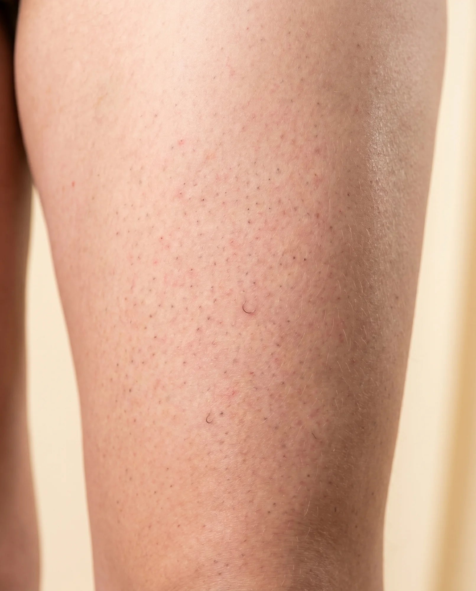 Strawberry legs before Pebble Serum
