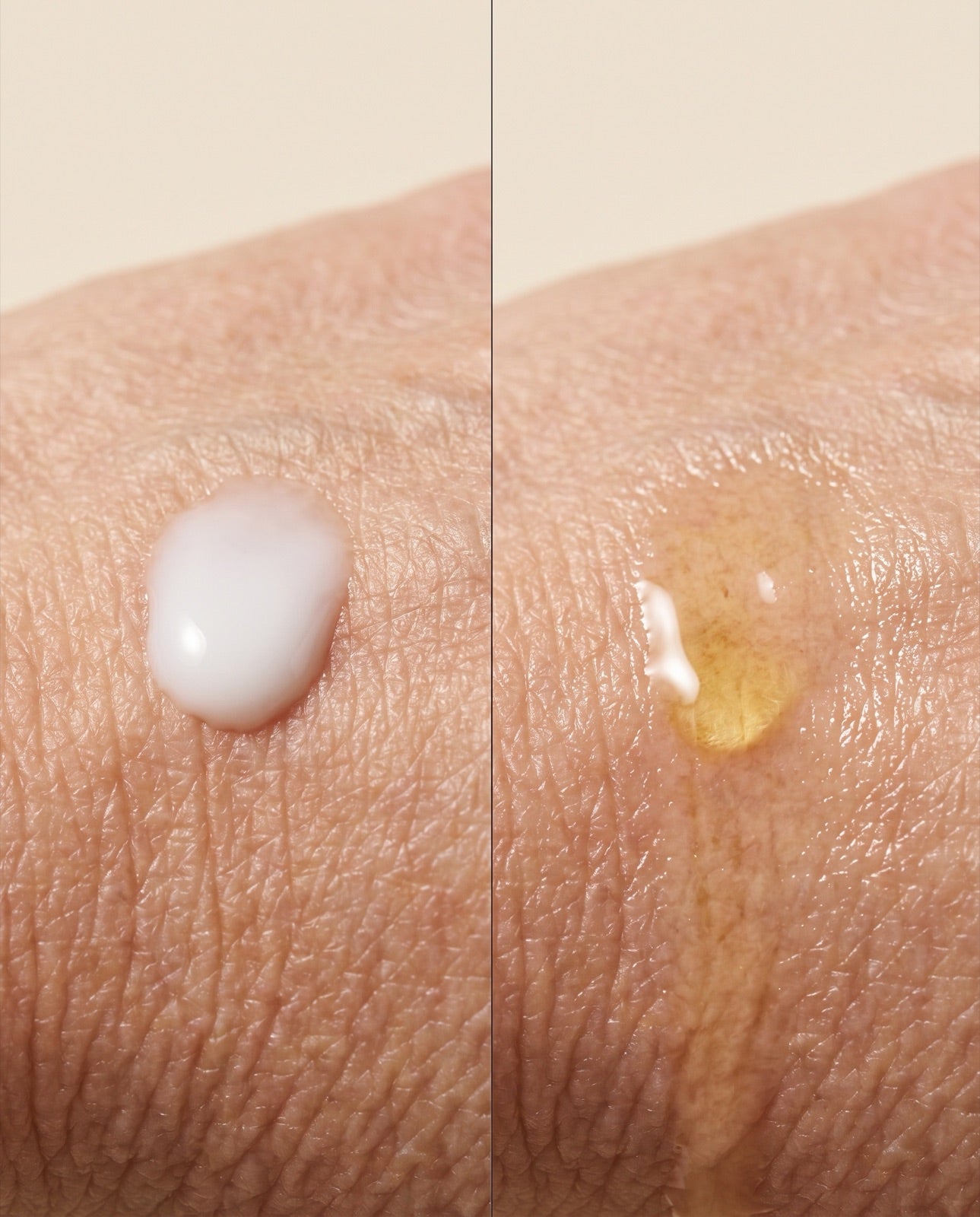 Diagram: water in lotion evaporates off the skin while lipids from dry oil sink into the barrier
