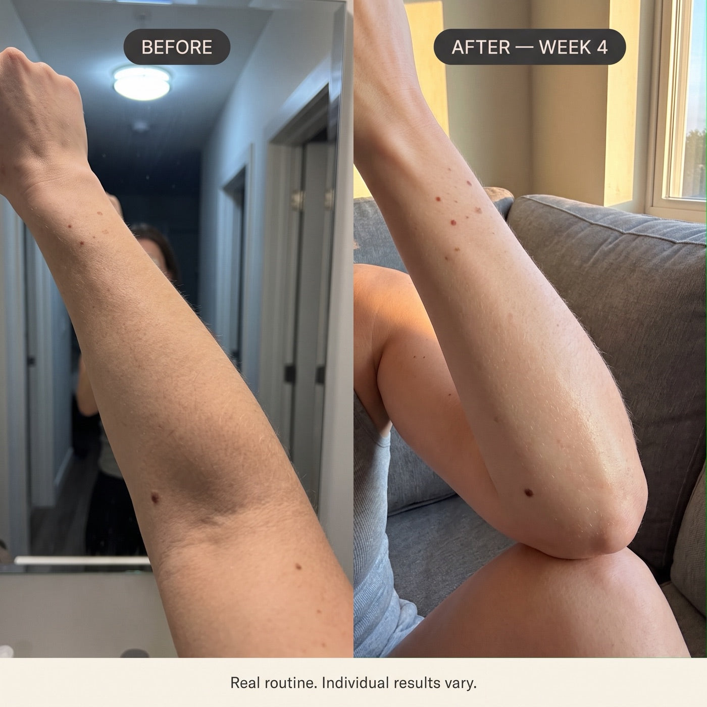 Customer photos of forearm, before and after four weeks