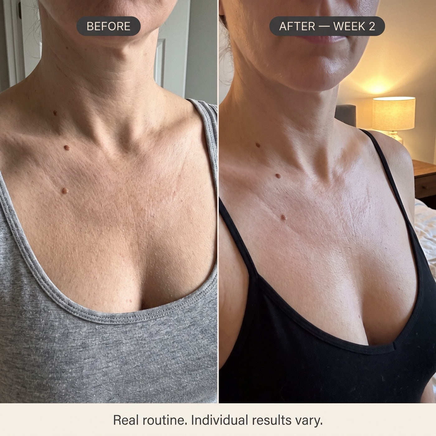 Customer photos of d&eacute;collet&eacute;, before and after two weeks of Silk Body Oil