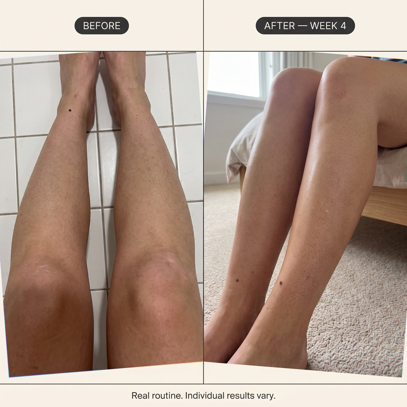 Customer photos of legs, before and after four weeks of Silk Body Oil