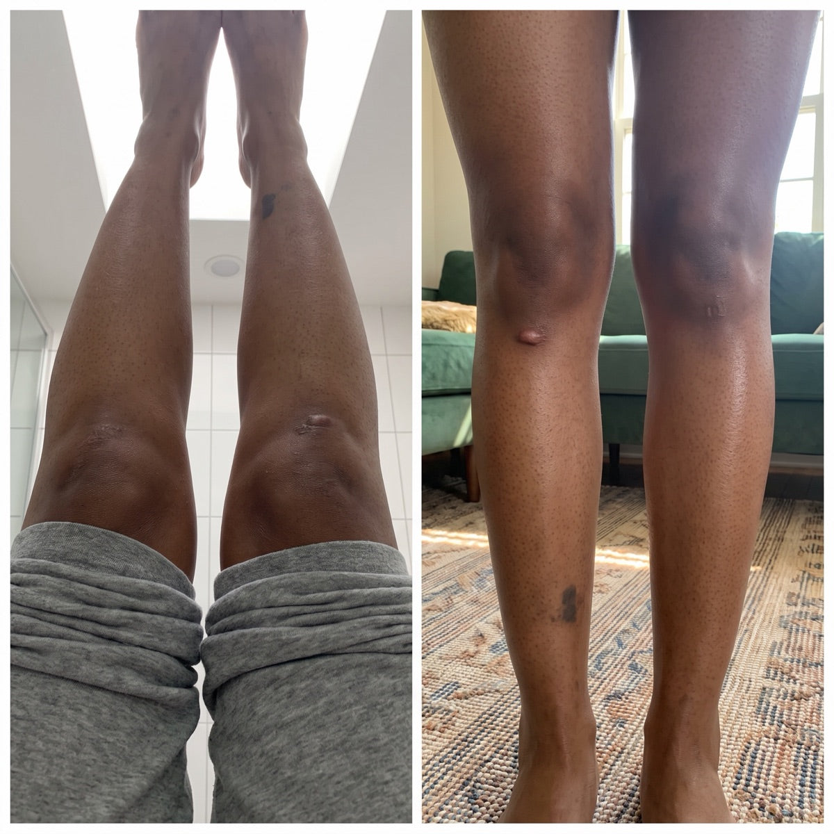 Customer photos of legs, before and after four weeks