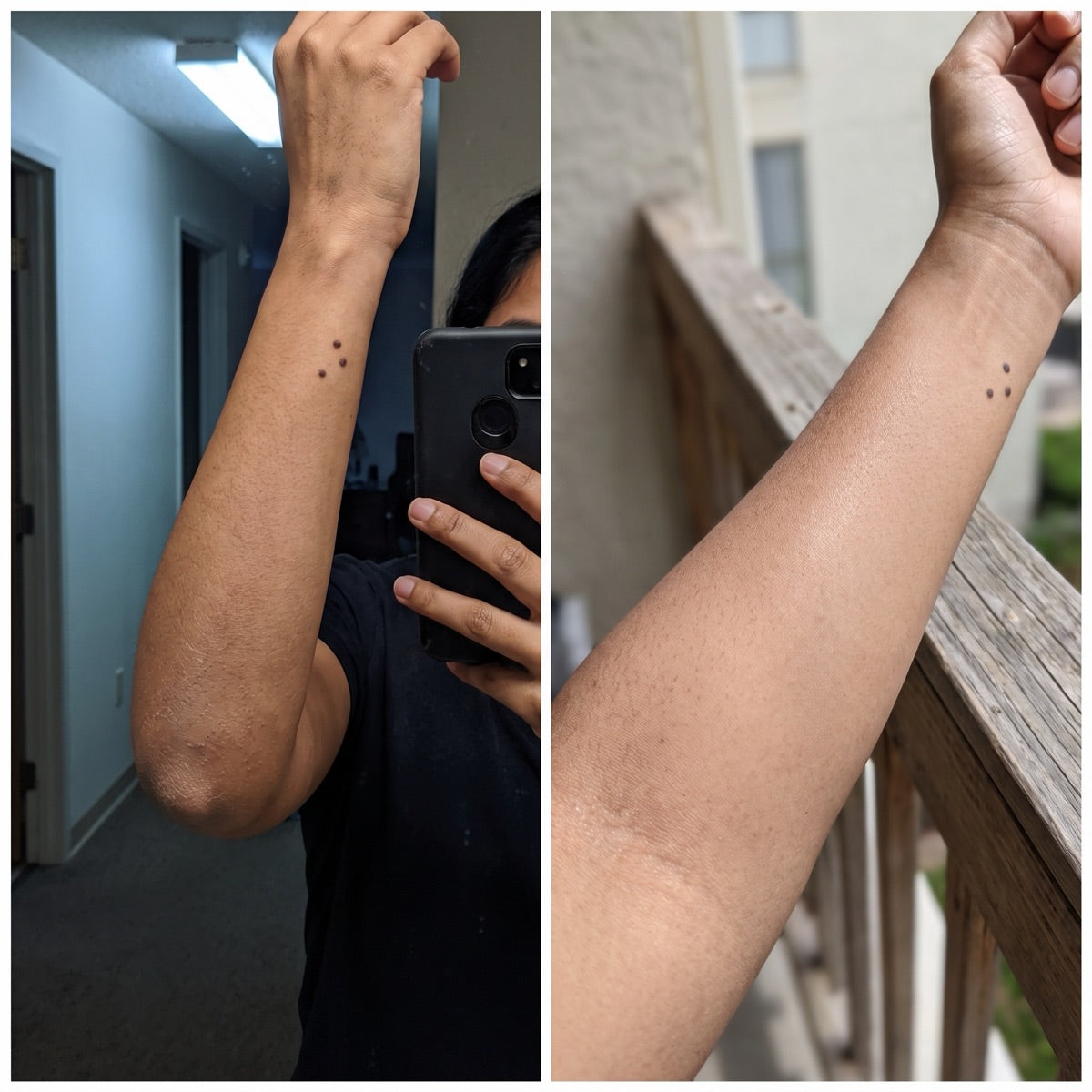 Customer photos of forearm, before and after