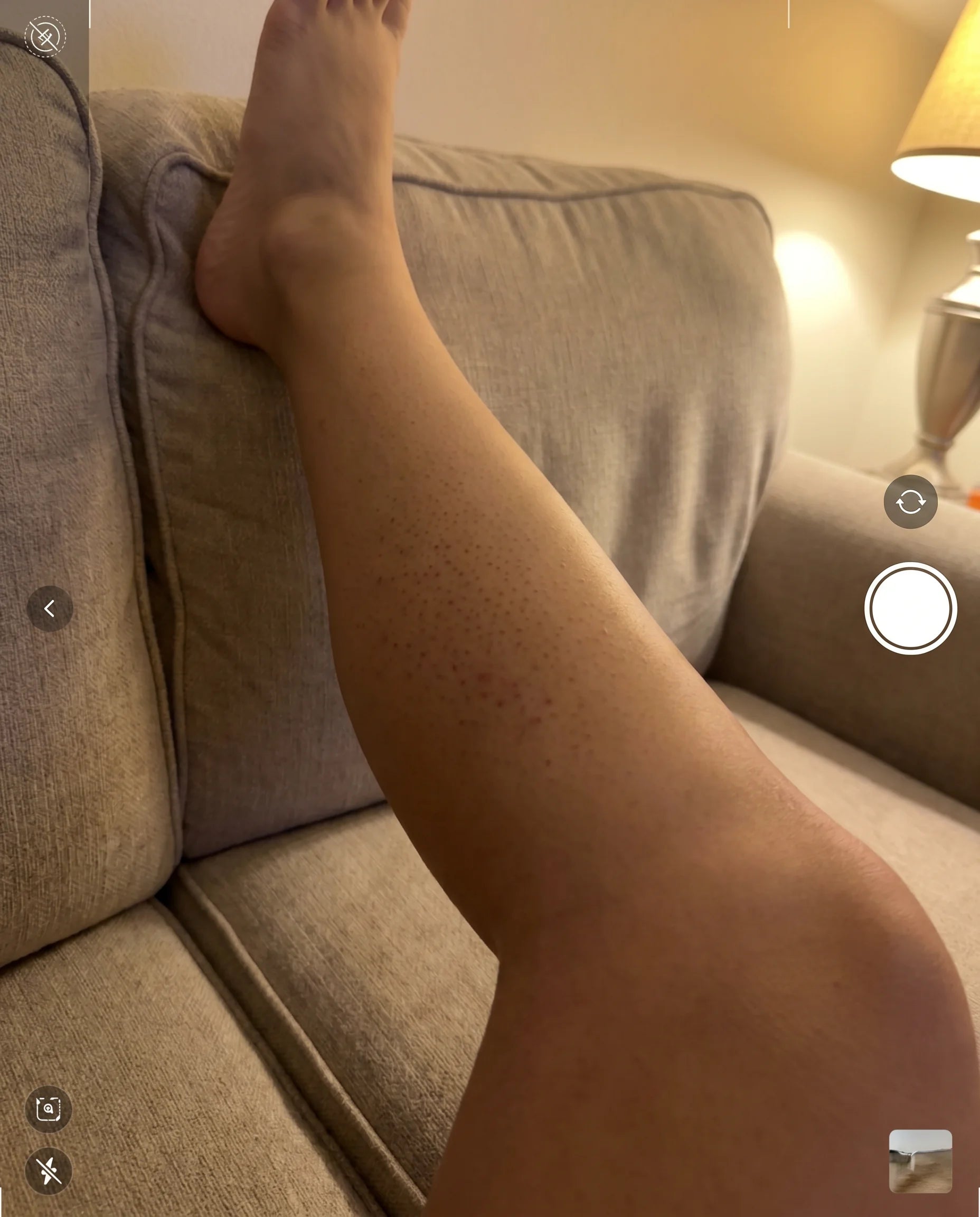 Olive-toned calf with keratosis pilaris before Pebble Serum