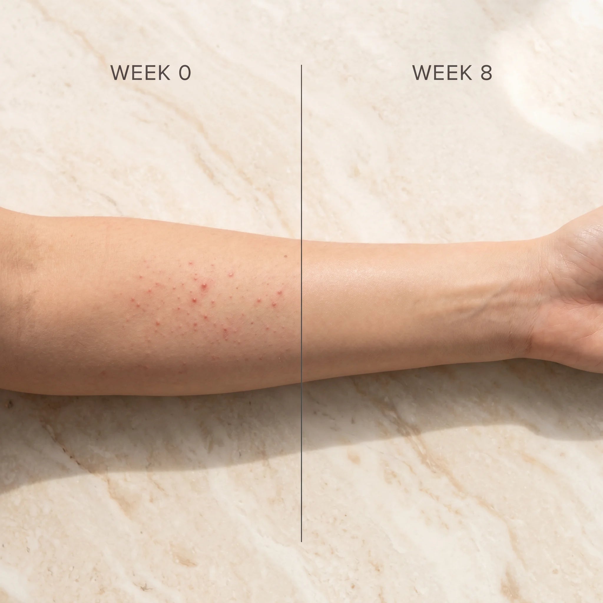 Before / after — same forearm at Week 0 with KP follicular bumps and Week 8 smooth, even-toned, on cream travertine.